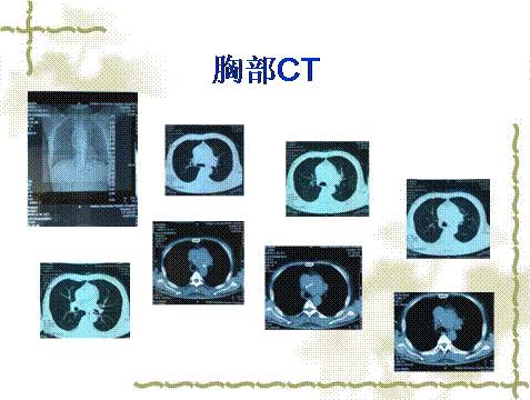 街头大山燕 大山我很乐意帮您进一步分析