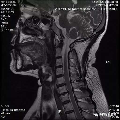 202509yoyo最新视频