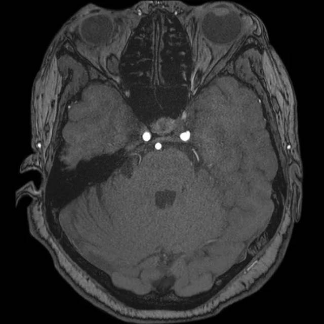 莉奈 经常在公园长椅上放松