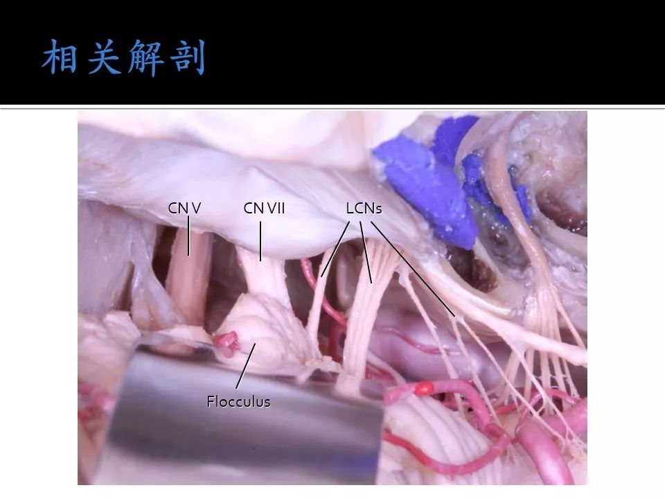 高挑 挺拔：侧重直立而精神