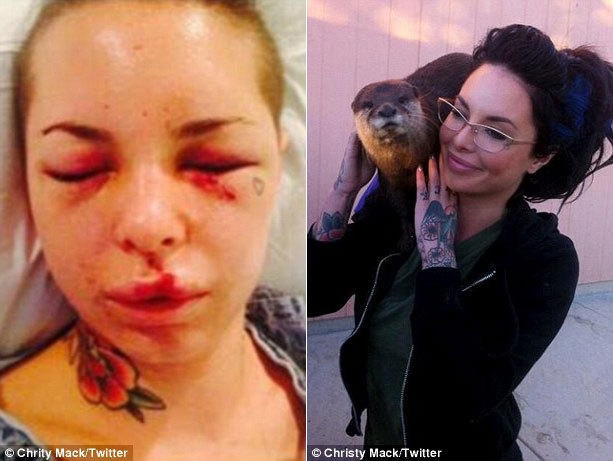 无限臀极 技艺超群的无限臀极象征